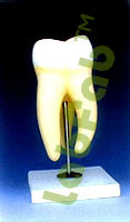HUMAN TOOTH, UPPER TRIPLE ROOT  6003007